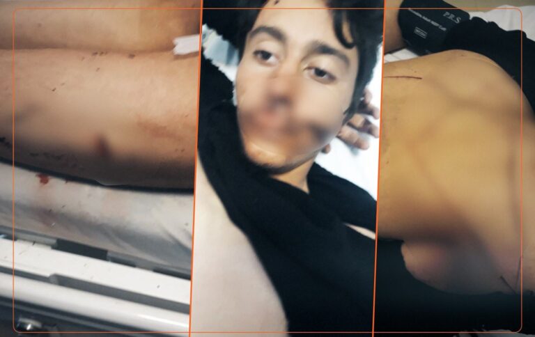 Hengaw Türk devletinin kolberlere yaptığı işkenceyi açıkladı; bir kolber öldürüldü biri yoğun bakımda