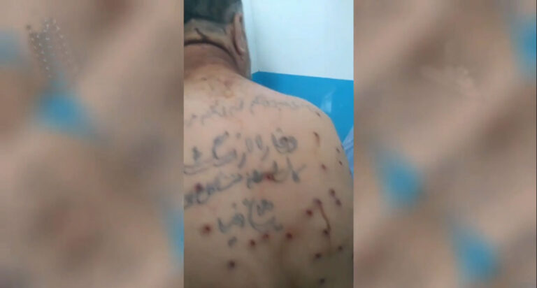 İran güçleri 12 kolberi gerçek mermi ile yaraladı, yaralılar hastaneye gidemiyor