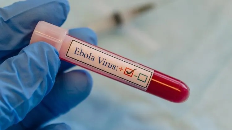 Binlerce ölüme sebep olan Ebola hastalığı Kerkük'te: 1 kişi hayatını kaybetti, 2 kişi tedavi altında