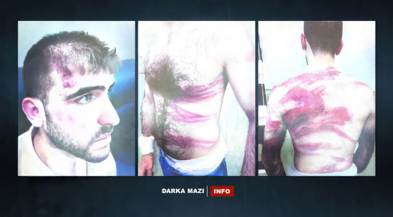 PKK’nin Haşdi Şabi içindeki savaşçıları sivil toplum örgütü çalışanına işkence yaptı, Erd Elxeyr, Taha Eymen, Şengal, Haşdi Şabi, Ezidi